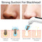 Upgraded Blackhead Remover Pore Vacuum